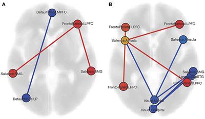 Brain Resting-State Network Alterations Associated With Crohn's Disease